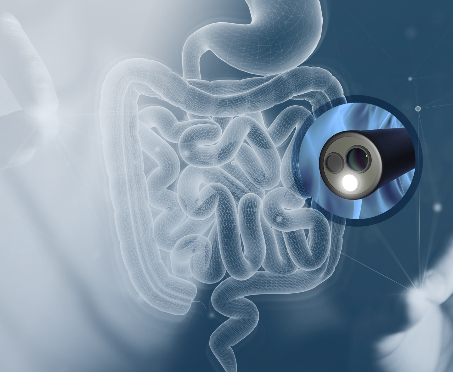 Endoscopy | Surgical Associates Pte Ltd