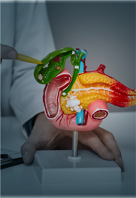 Choledochoscopy