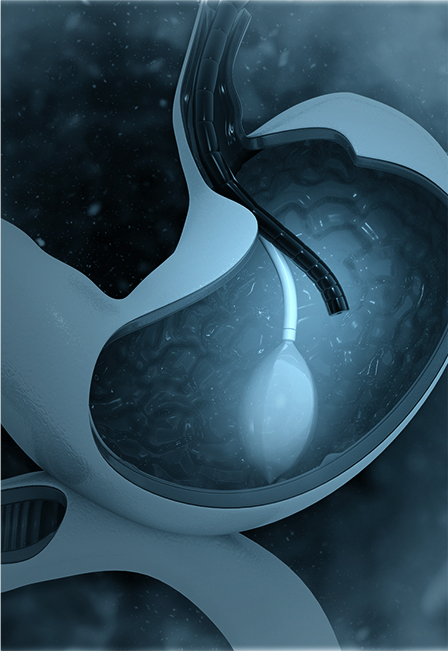 Gastroscopy
