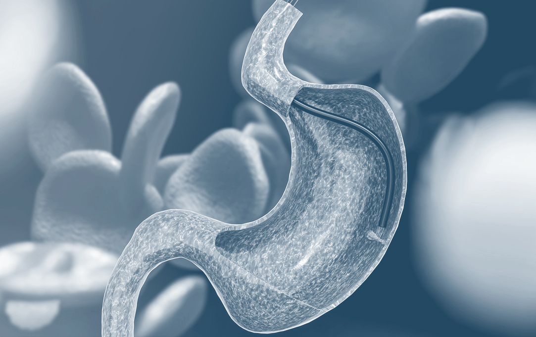 How Endoscopy Work